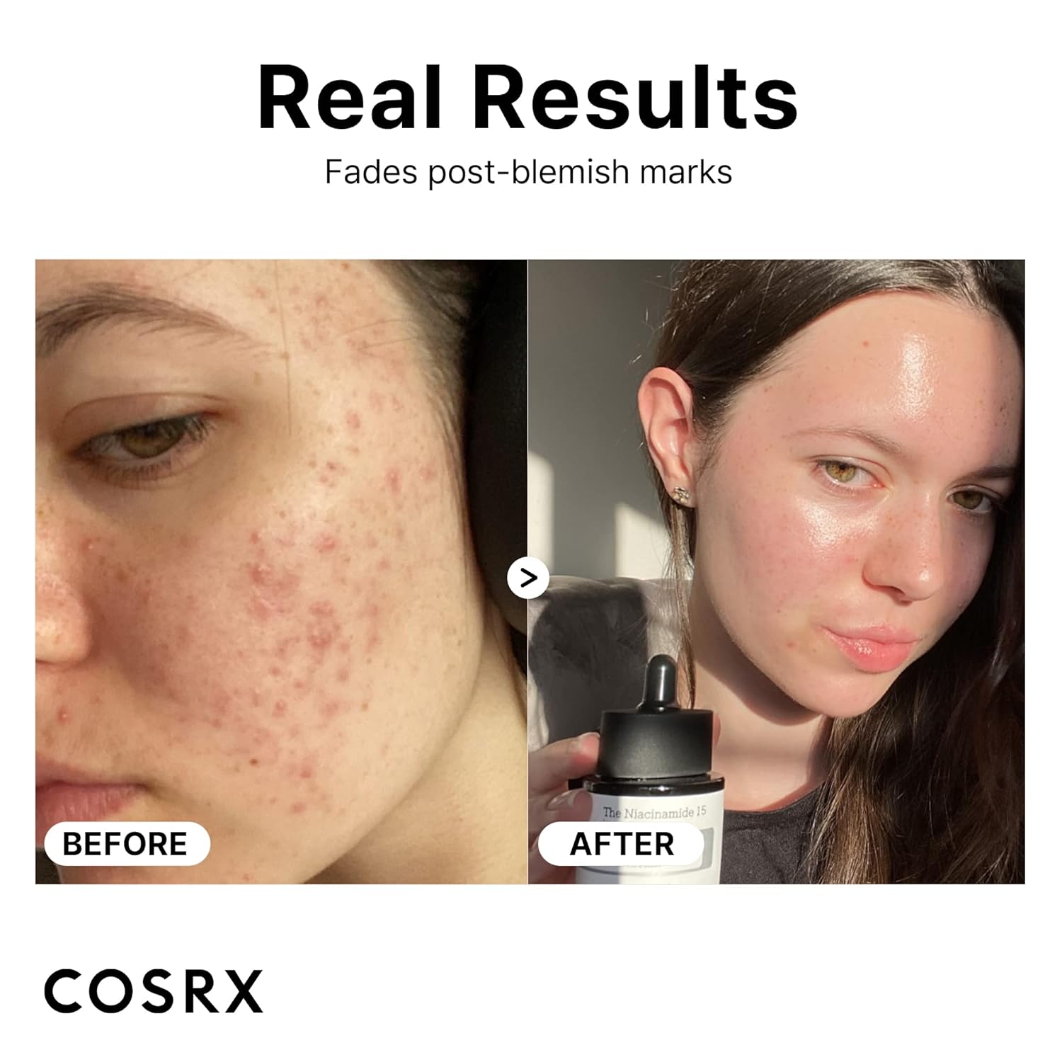 COSRX - Niacinamide 15% Face Serum
