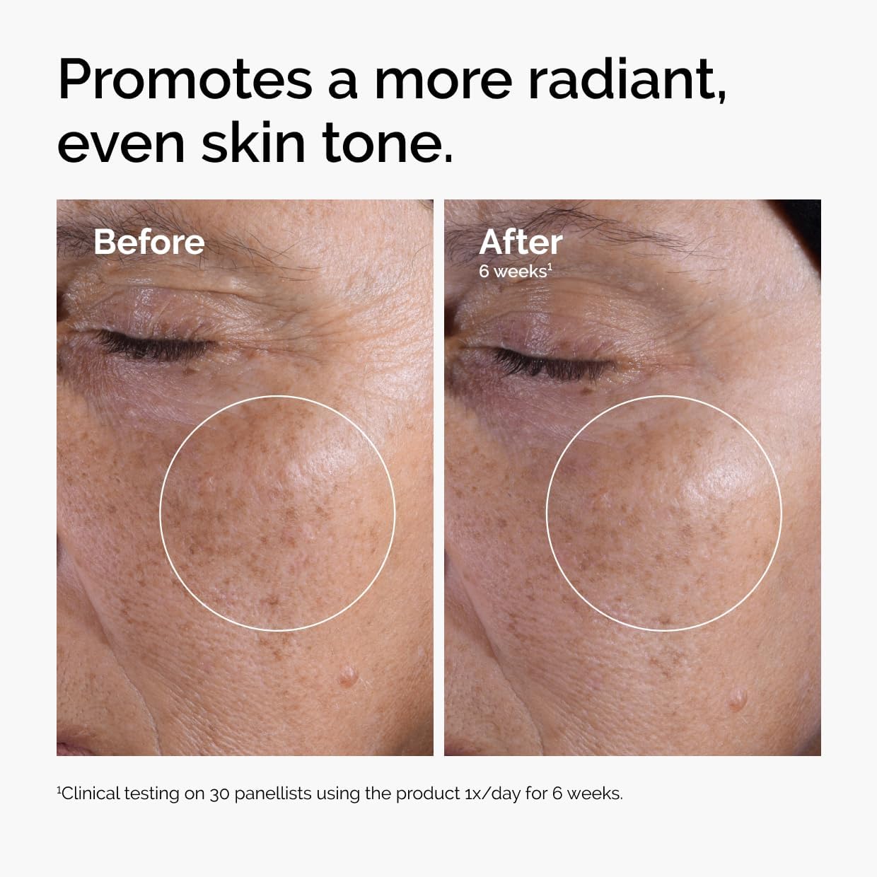 The Ordinary - Glycolic Acid 7% Toning Solution