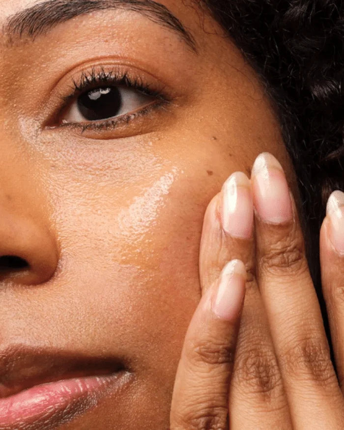 The Ordinary - Niacinamide 10% + Zinc 1%